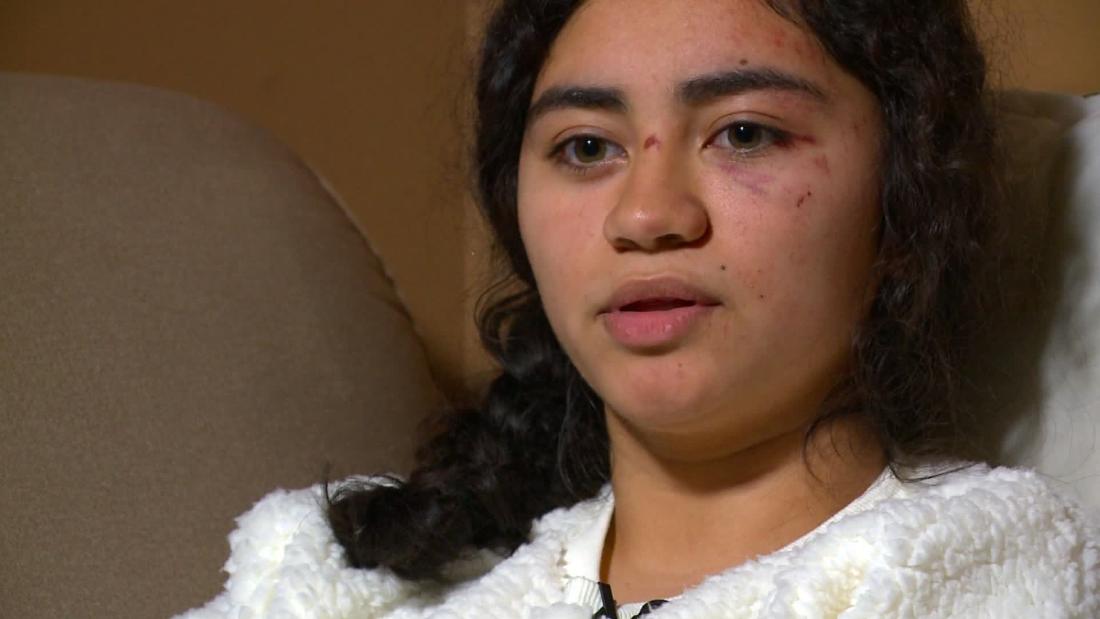 Hit and run victim: How did this happen