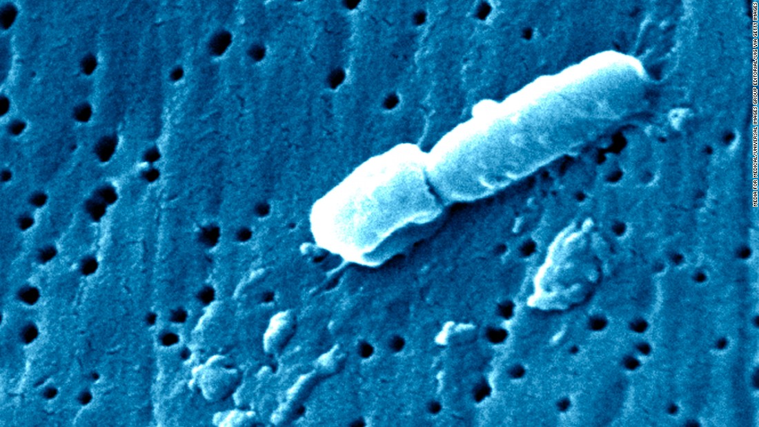 What is pneumonia?