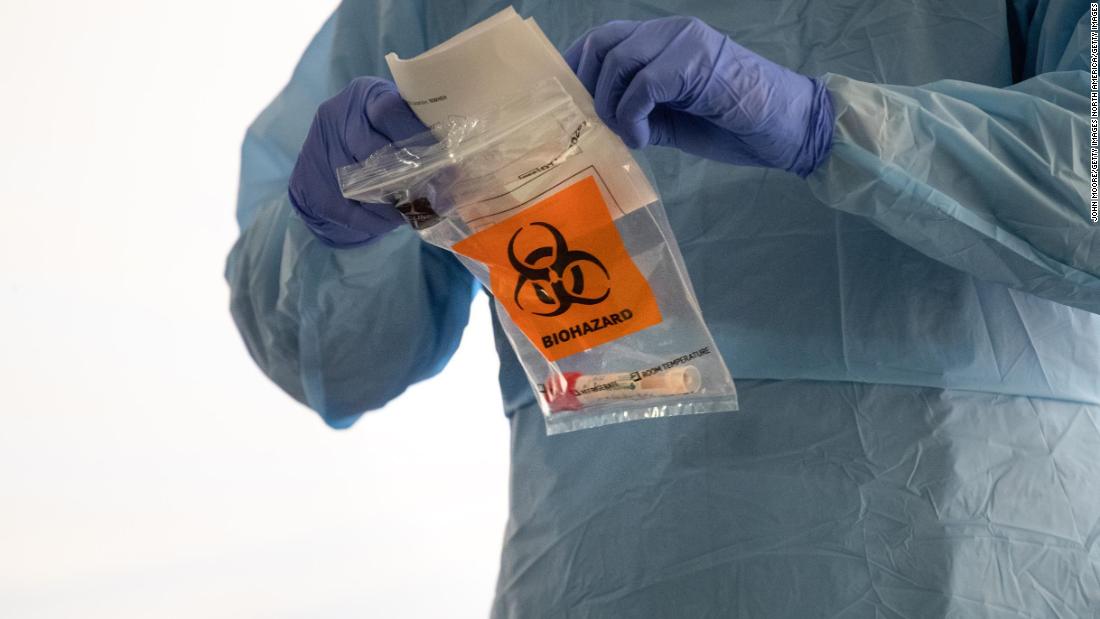 Here’s why the US is behind in coronavirus testing