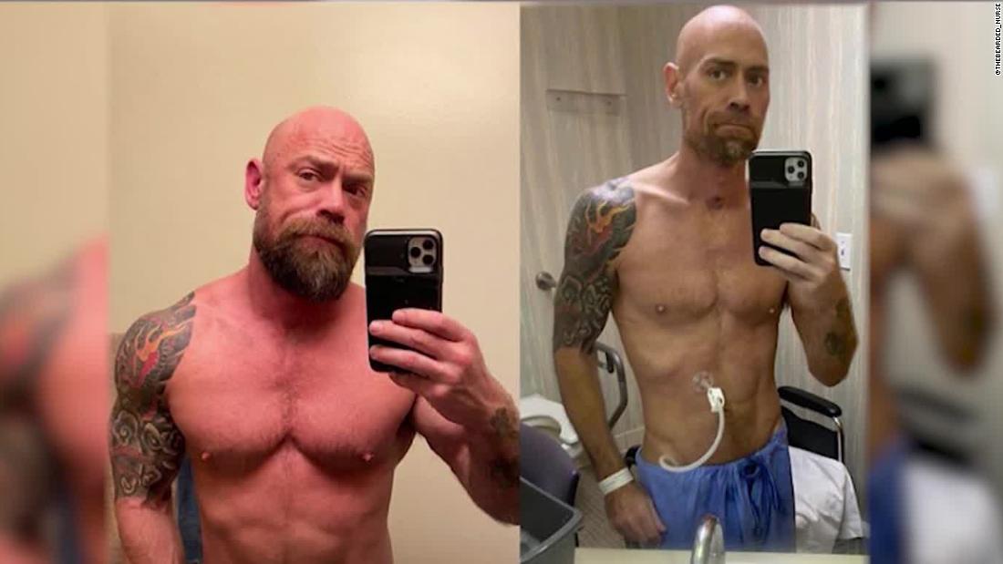 Coronavirus survivor shares shocking weight loss pictures