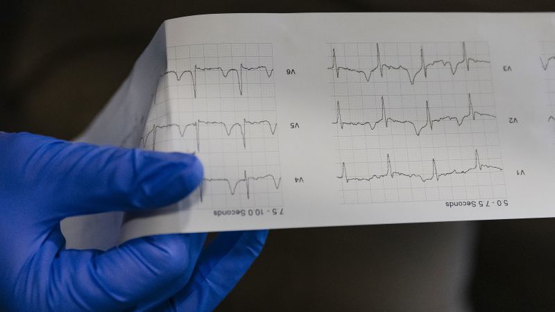 ‘There’s no excuse’: Why experts say this type of screening is crucial for young athletes and their future health